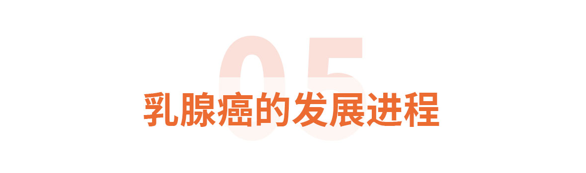 标题标题5乳腺癌的发展进程.jpg