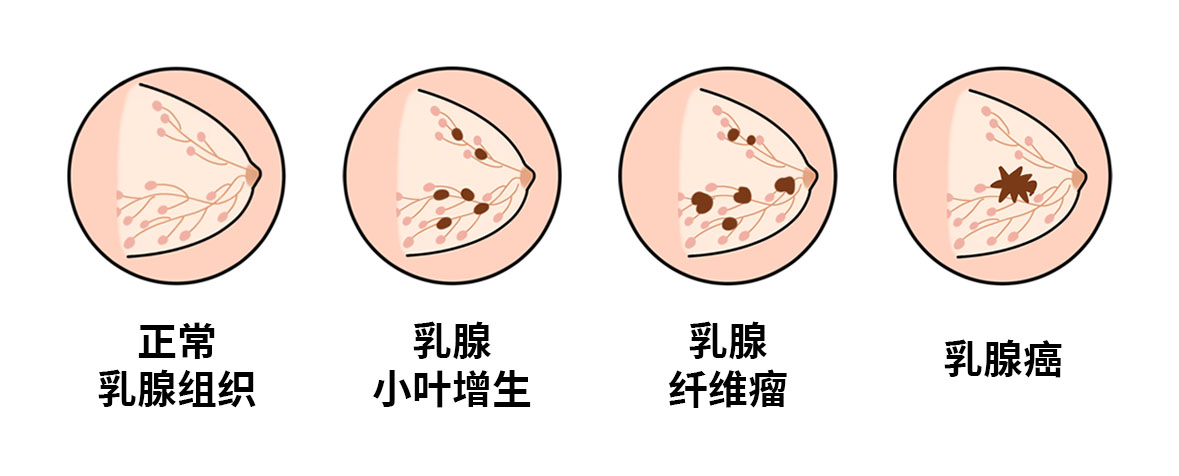 配图9发展.jpg